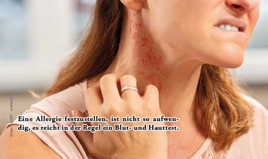 Eine Allergie festzustellen, ist nicht so aufwendig. Es reicht in der Regel ein Blut- und Hauttest.